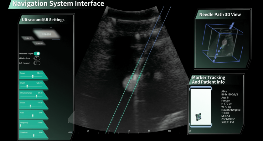 Medical Device Introduction Film